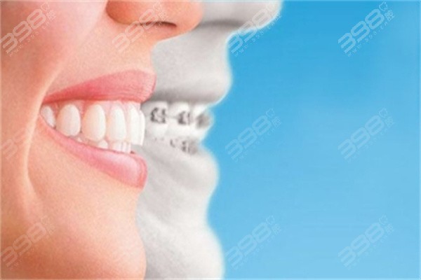 牙管家口腔医院牙齿矫正价格表