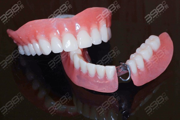 全口活动义齿有几种材料？纯钛/维他灵/吸附性义齿特点不同价格不同