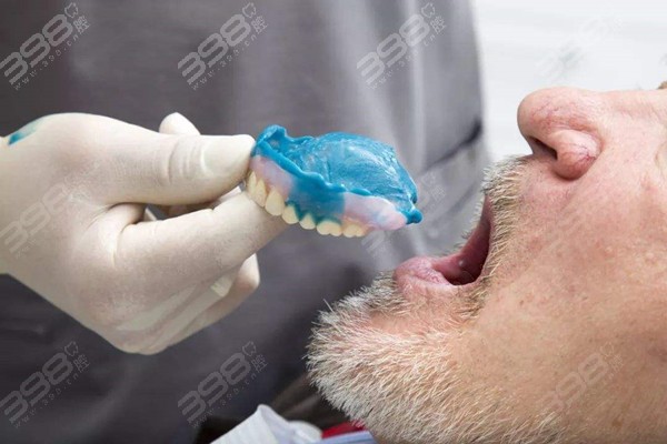 吸附性义齿价格