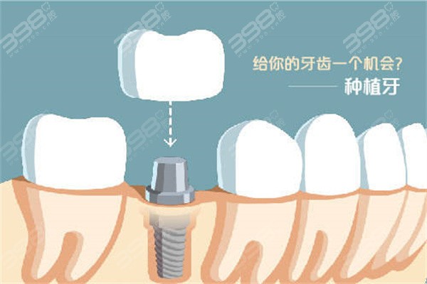 2024赤峰新版牙科收费