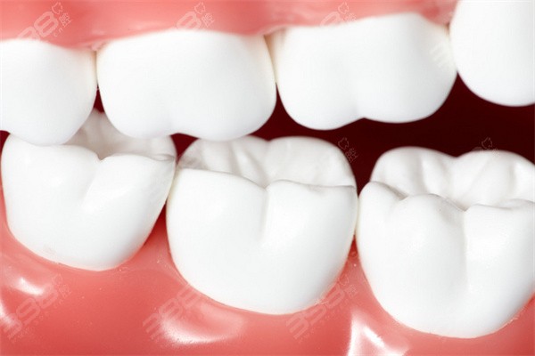 吸附性义齿怎么护理？