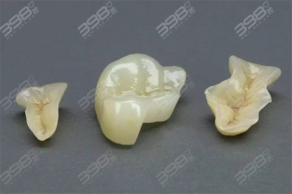 牙齿修复方式