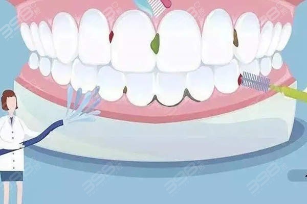 一个牙医的良心忠告洗牙的利与弊：洗牙亲身经历分享