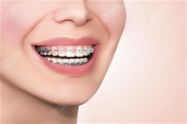 为了牙齿矫正来拔牙的利害有哪些？