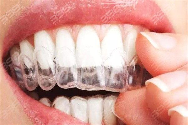 透明牙套矫正牙齿有年龄限制吗？和金属矫正比哪个效果更好？