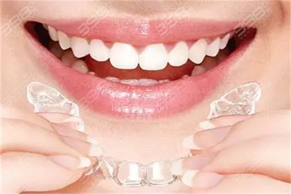 网上买的牙套真的可以矫正牙齿吗？良心牙医告诉你盲目购买有风险