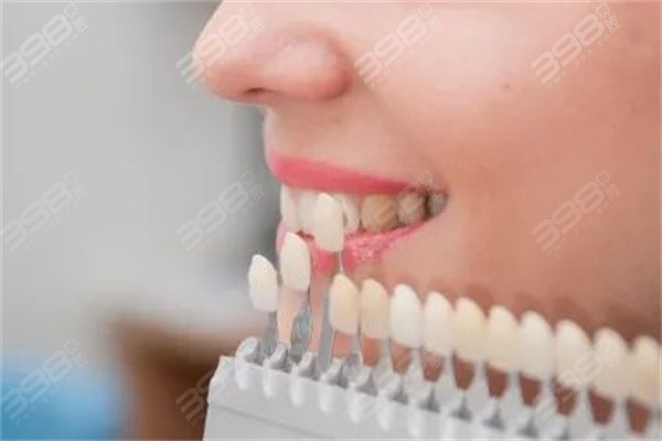 牙贴面一般做几颗牙？必须做全口吗？并不是，视牙齿情况而定