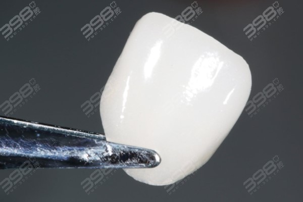 德国易美牙齿瓷贴面是什么材质的
