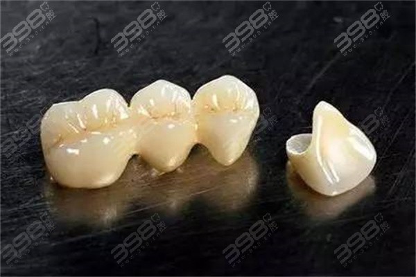 临时牙冠是什么材质做的
