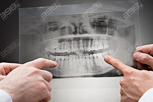 拍牙齿x光片多少钱？选择拍x光片能看出什么
