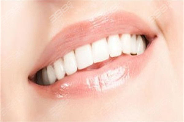 矫正牙齿可以直接戴隐形牙套吗？视情况而定，术前检查必不可少