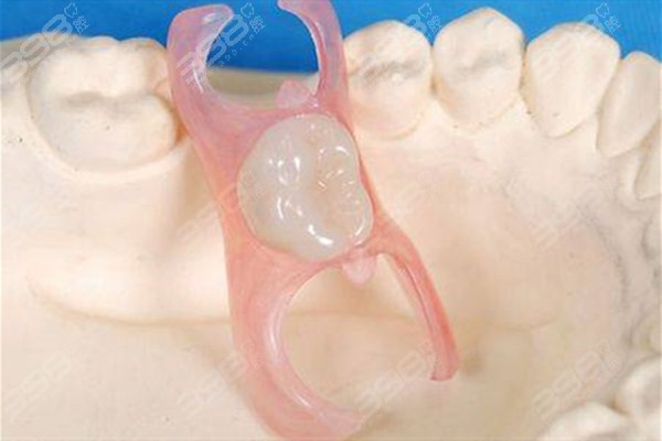 单颗活动义齿会损害邻牙吗？一般不会但可能会有牙龈萎缩的情况发生
